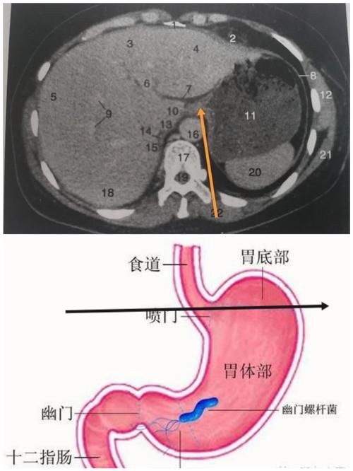 有沒有更多關于病理性膨脹的設定，“病理性膨脹”是什么意思？ 有沒有更多關于病理性膨脹的設定，“病理性膨脹”是什么意思？ 龍魚百科 第7張
