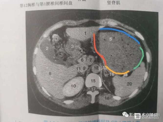 有沒有更多關于病理性膨脹的設定，“病理性膨脹”是什么意思？ 有沒有更多關于病理性膨脹的設定，“病理性膨脹”是什么意思？ 龍魚百科 第10張