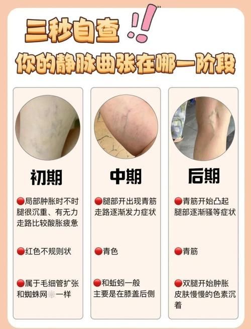 有沒有更多關于病理性膨脹的設定，“病理性膨脹”是什么意思？ 有沒有更多關于病理性膨脹的設定，“病理性膨脹”是什么意思？ 龍魚百科 第17張