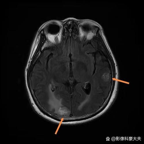 有沒有更多關于病理性膨脹的設定，“病理性膨脹”是什么意思？ 有沒有更多關于病理性膨脹的設定，“病理性膨脹”是什么意思？ 龍魚百科 第2張