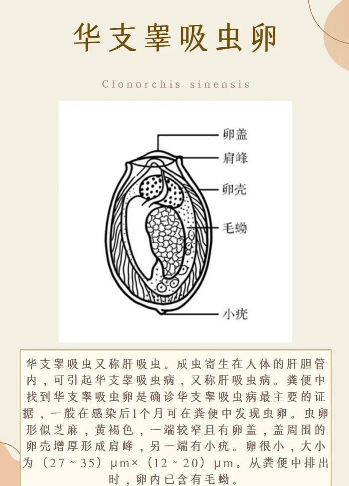 如何判斷自己是否感染了魚類寄生蟲,魚類寄生蟲感染 龍魚百科 第6張 如何判斷自己是否感染了魚類寄生蟲,魚類寄生蟲感染 如何判斷自己是否感染了魚類寄生蟲,魚類寄生蟲感染 龍魚百科 第6張