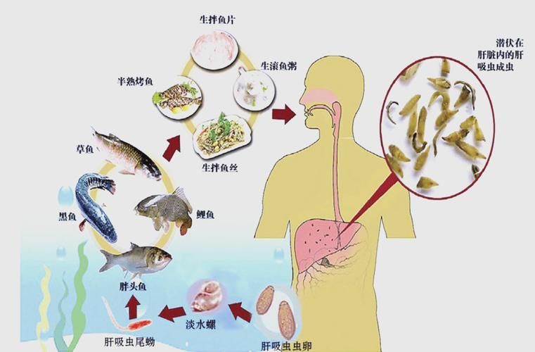 如何判斷自己是否感染了魚類寄生蟲，魚類寄生蟲感染