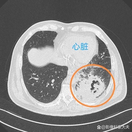 如何判斷自己是否感染了交叉病原體，交叉病原體感染指同一宿主同時(shí)或先后感染了交叉病原體 如何判斷自己是否感染了交叉病原體，交叉病原體感染指同一宿主同時(shí)或先后感染了交叉病原體 龍魚(yú)百科 第5張