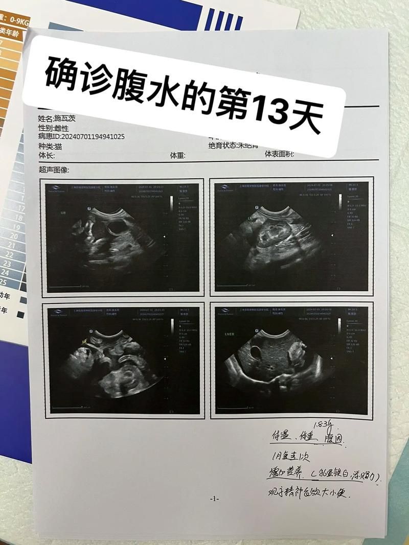 如何判斷腹水是否好轉(zhuǎn)，共調(diào)用2個(gè)工具判斷腹水是否好轉(zhuǎn) 如何判斷腹水是否好轉(zhuǎn)，共調(diào)用2個(gè)工具判斷腹水是否好轉(zhuǎn) 龍魚百科 第3張