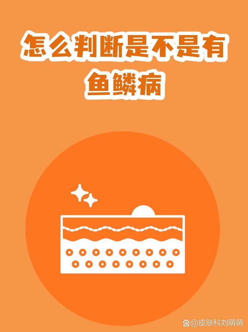 人類的魚鱗病有哪些類型，如何判斷魚鱗病？ 人類的魚鱗病有哪些類型，如何判斷魚鱗病？ 龍魚百科 第2張