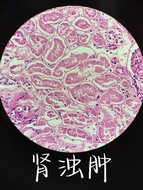 病理性浮頭如何治療,徐大王愛釣魚私藏技巧公開徐大王愛釣魚私藏技巧公開 龍魚百科 第5張 病理性浮頭如何治療,徐大王愛釣魚私藏技巧公開徐大王愛釣魚私藏技巧公開 病理性浮頭如何治療,徐大王愛釣魚私藏技巧公開徐大王愛釣魚私藏技巧公開 龍魚百科 第5張