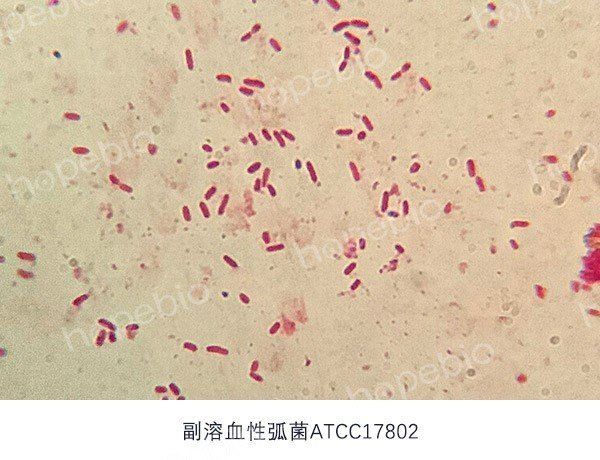 弧菌病有哪些防控措施，關(guān)于弧菌病的防控 弧菌病有哪些防控措施，關(guān)于弧菌病的防控 龍魚百科 第4張