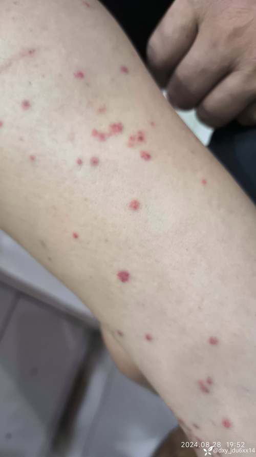 紅白錦鯉疾病如何治療？，關于紅白錦鯉疾病治療 紅白錦鯉疾病如何治療？，關于紅白錦鯉疾病治療 龍魚百科 第5張