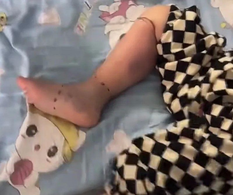 如何預防魚類細菌感染人體，預防魚類細菌感染人體的方法