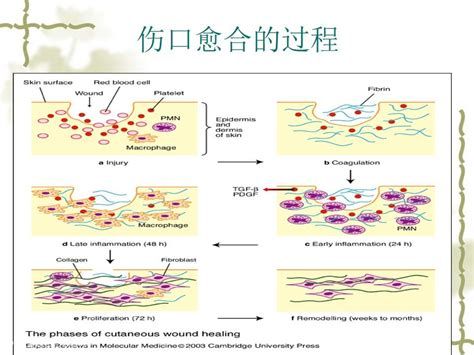 被龍魚咬爛的傷口會自愈嗎？，被龍魚咬傷傷口能自愈嗎？