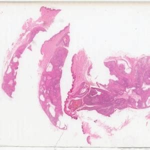 詳細(xì)閱讀:龍魚(yú)腹部腫脹要警惕了,龍魚(yú)腹部腫脹怎么辦 龍魚(yú)腹部腫脹要警惕了,龍魚(yú)腹部腫脹怎么辦
