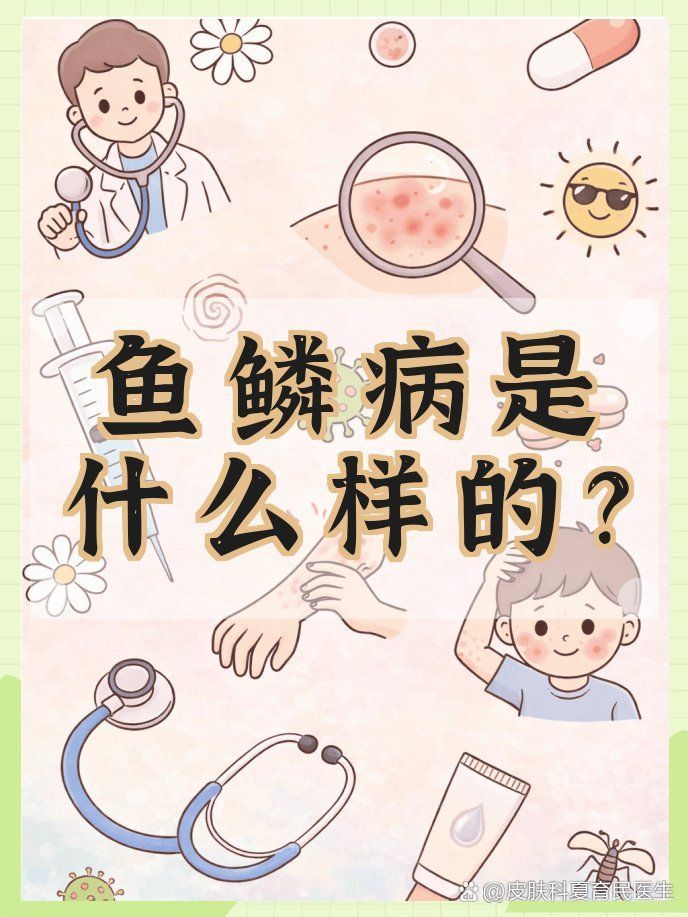 魚鱗病有哪些類型，@皮膚科夏育民醫(yī)生怎么判斷魚鱗病是什么樣的魚鱗病