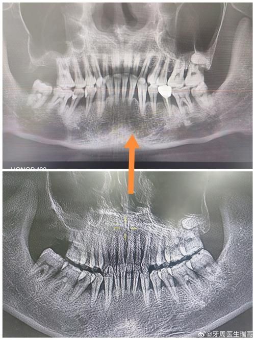 xlyc圖片5張2有哪些識別特征？，xlyc圖片5張2有哪些識別特征 xlyc圖片5張2有哪些識別特征？，xlyc圖片5張2有哪些識別特征 龍魚百科 第9張