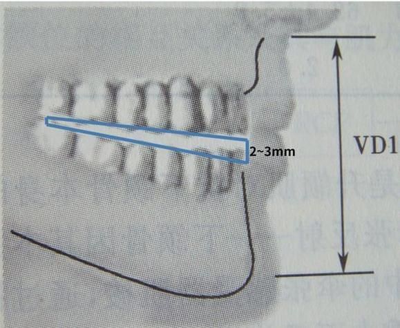 xlyc圖片5張2有哪些識別特征？，xlyc圖片5張2有哪些識別特征 xlyc圖片5張2有哪些識別特征？，xlyc圖片5張2有哪些識別特征 龍魚百科 第12張
