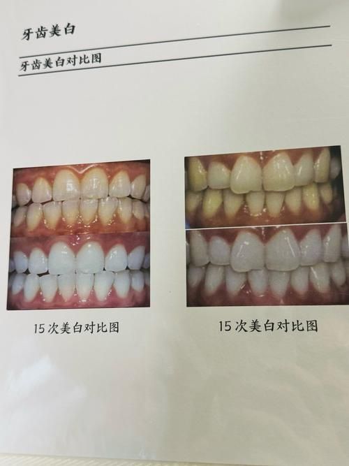 xlyc圖片5張2有哪些識別特征？，xlyc圖片5張2有哪些識別特征 xlyc圖片5張2有哪些識別特征？，xlyc圖片5張2有哪些識別特征 龍魚百科 第11張