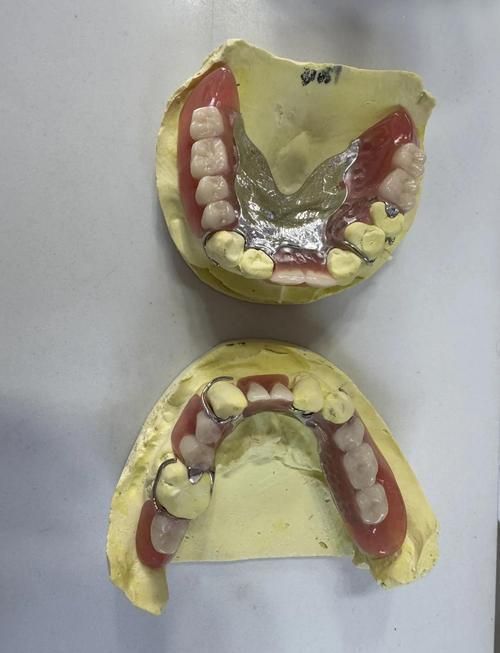 xlyc圖片5張2有哪些識別特征？，xlyc圖片5張2有哪些識別特征 xlyc圖片5張2有哪些識別特征？，xlyc圖片5張2有哪些識別特征 龍魚百科 第2張