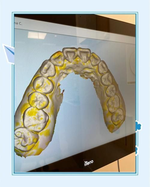 xlyc圖片5張2有哪些識別特征？，xlyc圖片5張2有哪些識別特征