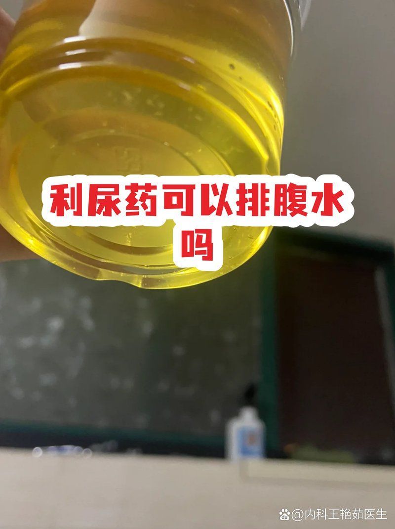 有哪些藥物可以輔助排腹水，利尿藥可以排腹水嗎