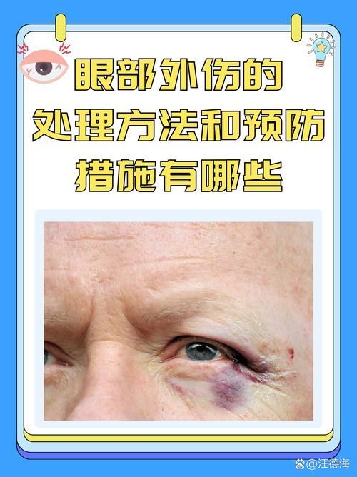 黃粉治療蒙眼病有哪些副作用，黃粉治療“蒙眼病”