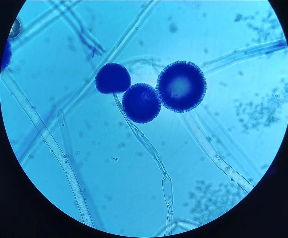 黃粉治療黑霉有哪些副作用,黃粉治療黑霉有哪些副作用調用工具 龍魚百科 第1張 黃粉治療黑霉有哪些副作用,黃粉治療黑霉有哪些副作用調用工具 黃粉治療黑霉有哪些副作用,黃粉治療黑霉有哪些副作用調用工具 龍魚百科 第1張