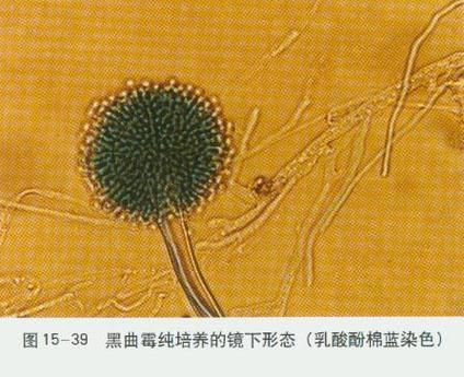 黃粉治療黑霉有哪些副作用,黃粉治療黑霉有哪些副作用調用工具 龍魚百科 第4張 黃粉治療黑霉有哪些副作用,黃粉治療黑霉有哪些副作用調用工具 黃粉治療黑霉有哪些副作用,黃粉治療黑霉有哪些副作用調用工具 龍魚百科 第4張