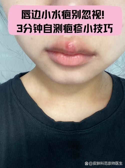 如何治療魚嘴凸起白色包，如何治療魚嘴凸起白色凸起性淡黃 如何治療魚嘴凸起白色包，如何治療魚嘴凸起白色凸起性淡黃 龍魚百科 第4張