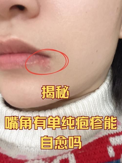 如何治療魚嘴凸起白色包，如何治療魚嘴凸起白色凸起性淡黃 如何治療魚嘴凸起白色包，如何治療魚嘴凸起白色凸起性淡黃 龍魚百科 第2張