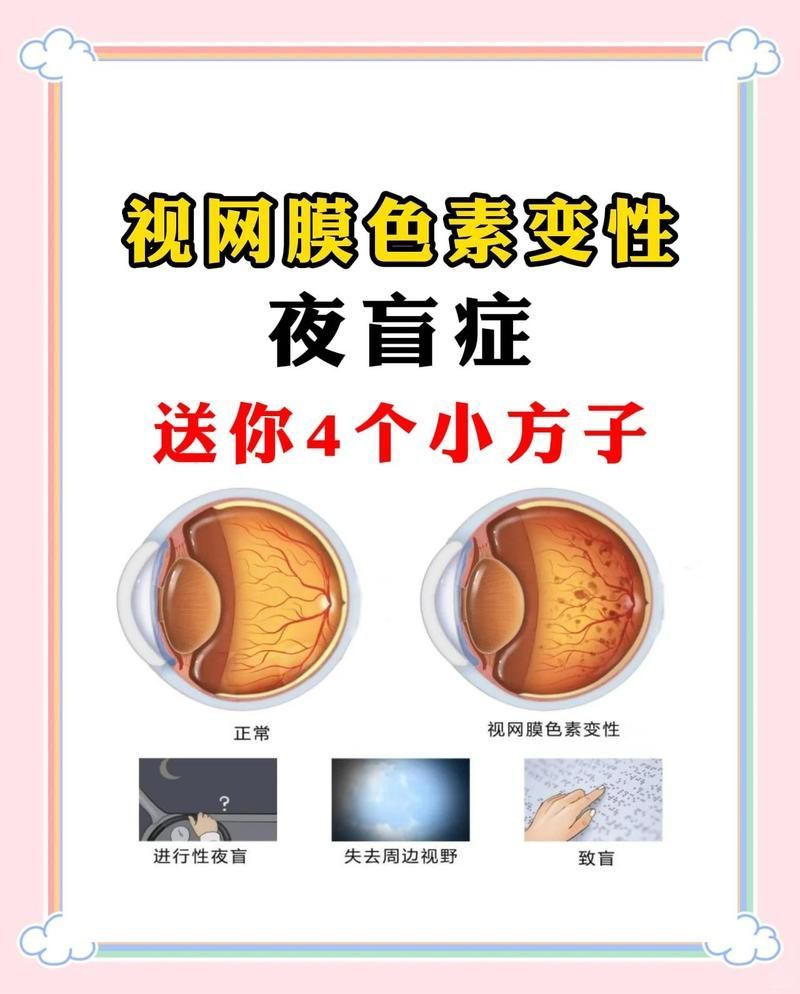 有哪些方法可以改善夜盲癥，夜盲癥如何改善