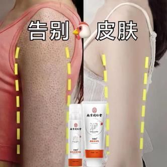 有哪些保濕產(chǎn)品適合魚鱗病患者