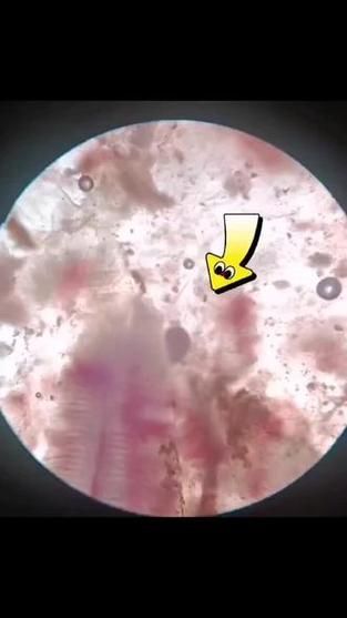 如何判斷龍魚腮上小氣泡是否為氣泡病？，如何判斷龍魚腮上小氣泡是否為氣泡病 如何判斷龍魚腮上小氣泡是否為氣泡病？，如何判斷龍魚腮上小氣泡是否為氣泡病 龍魚百科 第4張