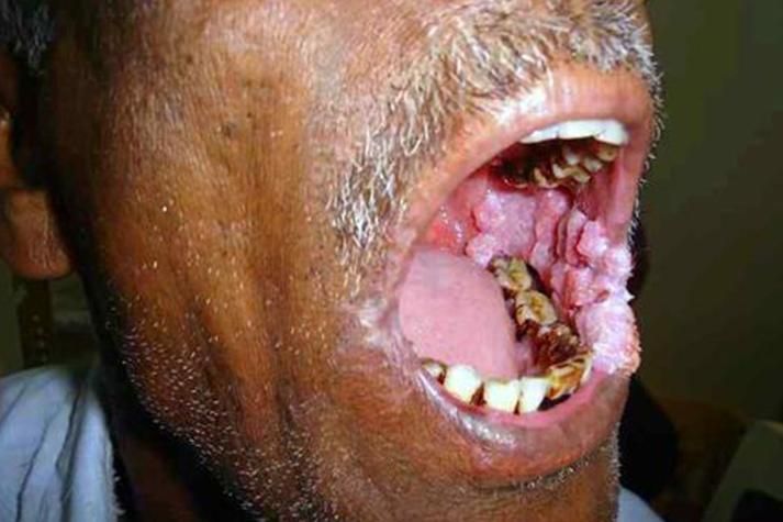 如何區分龍魚嘴巴的良性與惡性腫瘤?,如何區分龍魚嘴巴的良性與惡性腫瘤并明確要求1000字說明和配圖 龍魚百科 第5張 如何區分龍魚嘴巴的良性與惡性腫瘤?,如何區分龍魚嘴巴的良性與惡性腫瘤并明確要求1000字說明和配圖 如何區分龍魚嘴巴的良性與惡性腫瘤?,如何區分龍魚嘴巴的良性與惡性腫瘤并明確要求1000字說明和配圖 龍魚百科 第5張