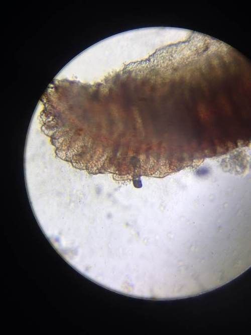 紅龍魚寄生蟲感染如何防治？，紅龍魚寄生蟲感染的防治方法分享石師傅影綜紀(jì)實錄展開 紅龍魚寄生蟲感染如何防治？，紅龍魚寄生蟲感染的防治方法分享石師傅影綜紀(jì)實錄展開 龍魚百科 第5張