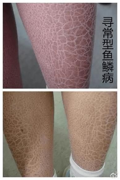 能否提供更多關于魚鱗病的圖片,如何鑒別魚鱗病 龍魚百科 第4張 能否提供更多關于魚鱗病的圖片,如何鑒別魚鱗病 能否提供更多關于魚鱗病的圖片,如何鑒別魚鱗病 龍魚百科 第4張