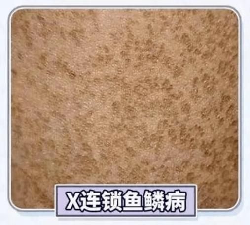 能否提供更多關于魚鱗病的圖片,如何鑒別魚鱗病 龍魚百科 第5張 能否提供更多關于魚鱗病的圖片,如何鑒別魚鱗病 能否提供更多關于魚鱗病的圖片,如何鑒別魚鱗病 龍魚百科 第5張
