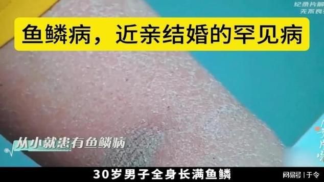 能否提供更多關于魚鱗病的圖片,如何鑒別魚鱗病 龍魚百科 第6張 能否提供更多關于魚鱗病的圖片,如何鑒別魚鱗病 能否提供更多關于魚鱗病的圖片,如何鑒別魚鱗病 龍魚百科 第6張