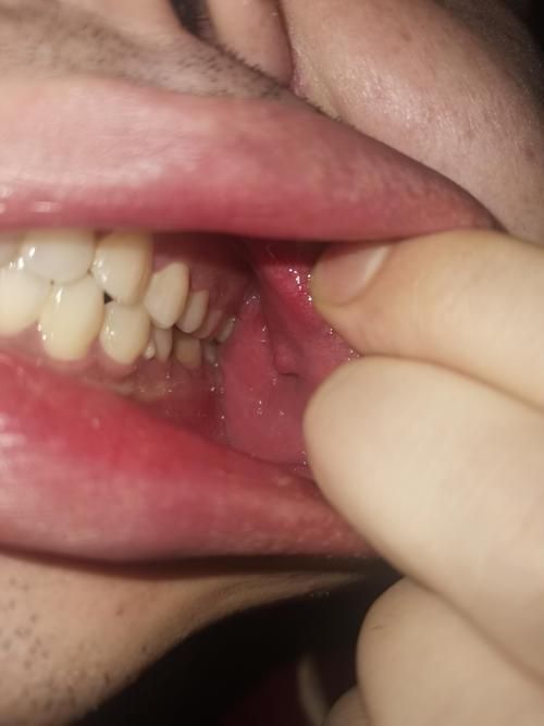 如何區分龍魚嘴上的肉球是腫瘤還是腫斑病？，如何區分龍魚嘴上的肉球是腫瘤還是腫斑病