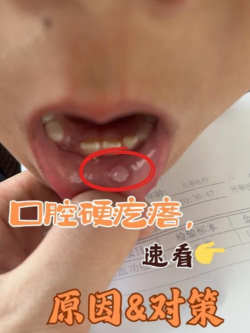 如何區分龍魚嘴上的肉球是腫瘤還是腫斑病？，如何區分龍魚嘴上的肉球是腫瘤還是腫斑病