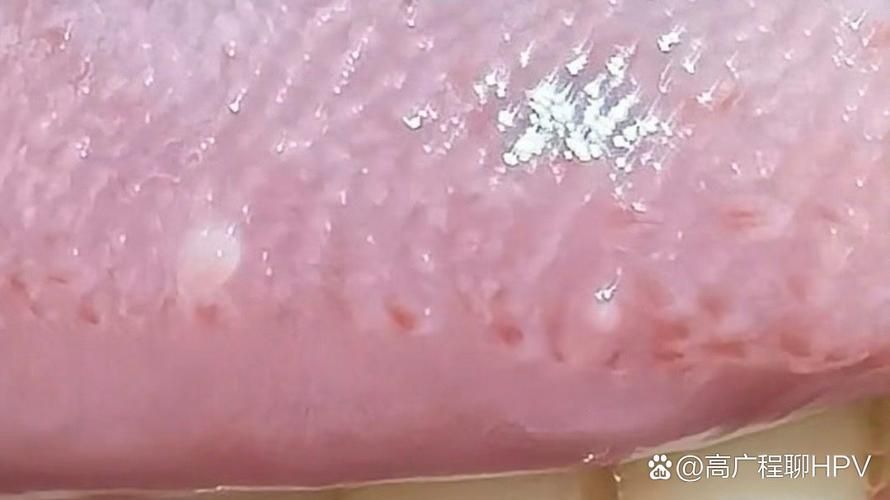 如何區分龍魚嘴上的肉球是腫瘤還是腫斑病？，如何區分龍魚嘴上的肉球是腫瘤還是腫斑病