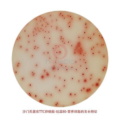 西安地區春季腸炎高發原因