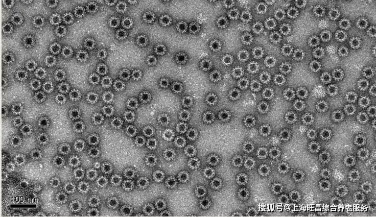 西安地區春季腸炎高發原因