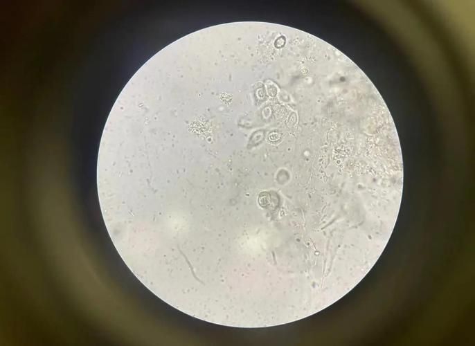 黃鰭鯧魚寄生蟲病如何治療？，黃鰭鯧魚如何治療寄生蟲病 黃鰭鯧魚寄生蟲病如何治療？，黃鰭鯧魚如何治療寄生蟲病 龍魚百科 第6張