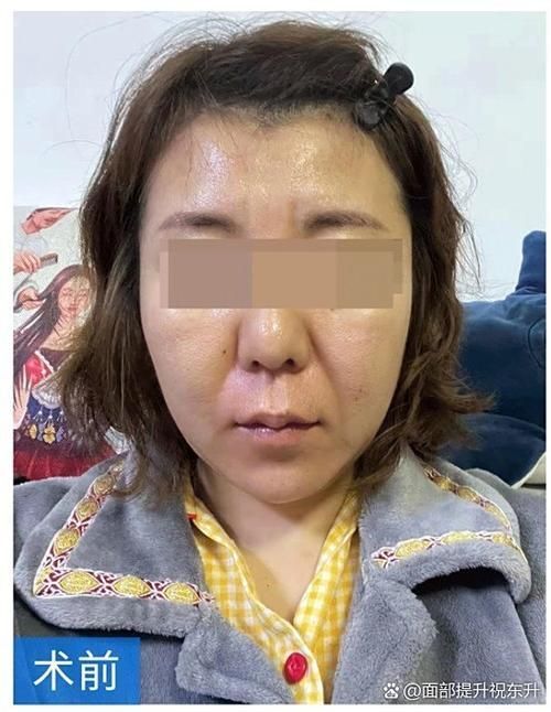 炸鱗病自愈后需要多久恢復活力，炸鱗病自愈后恢復活力共調用2個工具、鱗片再生過程圖文詳解