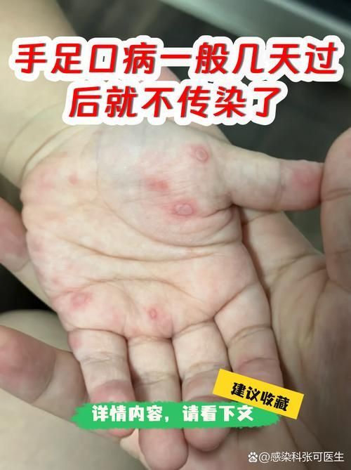交叉感染后如何護理,交叉感染后如何護理思考完成共調(diào)用2個工具 龍魚百科 第5張 交叉感染后如何護理,交叉感染后如何護理思考完成共調(diào)用2個工具 交叉感染后如何護理,交叉感染后如何護理思考完成共調(diào)用2個工具 龍魚百科 第5張