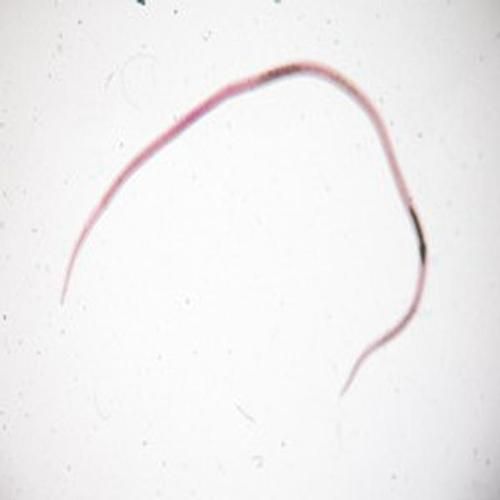 如何預(yù)防鲅魚寄生蟲感染，如何科學(xué)預(yù)防鲅魚寄生蟲感染