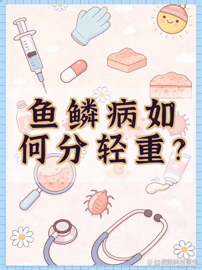 人類魚鱗病有哪些類型