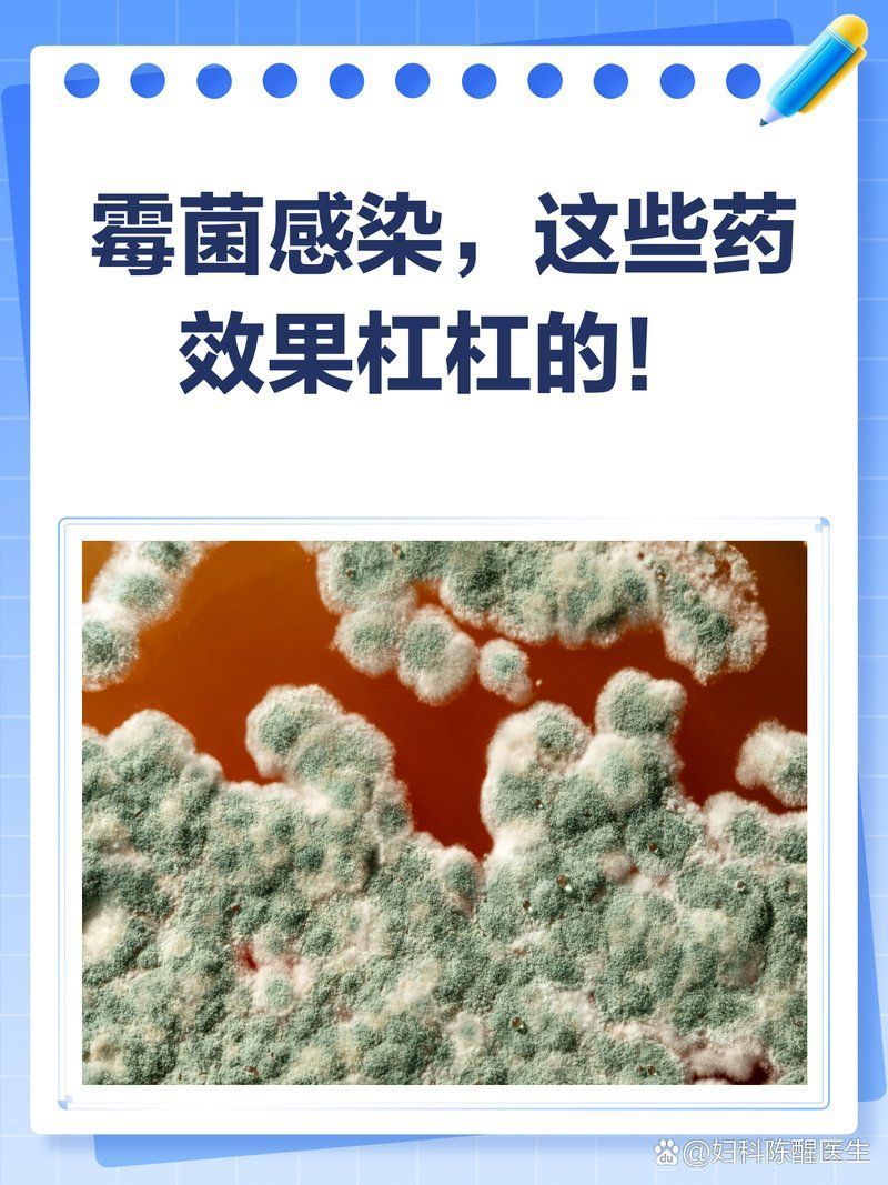 有哪些藥物可以治療霉菌感染，治療霉菌感染的藥物
