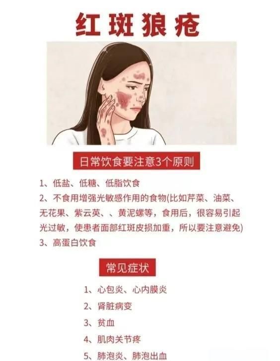 給我推薦一些紅斑病治療期間的食物，紅斑病患者的飲食建議