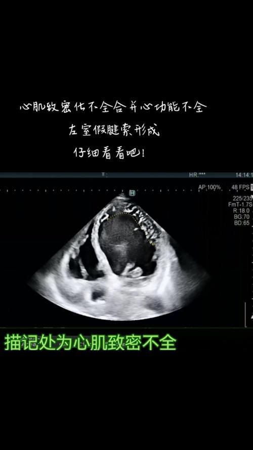 能否給出更多診斷案例,三甲醫院醫療診斷案例“1000字和配圖)能否給出更多診斷案例 龍魚百科 第8張 能否給出更多診斷案例,三甲醫院醫療診斷案例“1000字和配圖)能否給出更多診斷案例 能否給出更多診斷案例,三甲醫院醫療診斷案例“1000字和配圖)能否給出更多診斷案例 龍魚百科 第8張