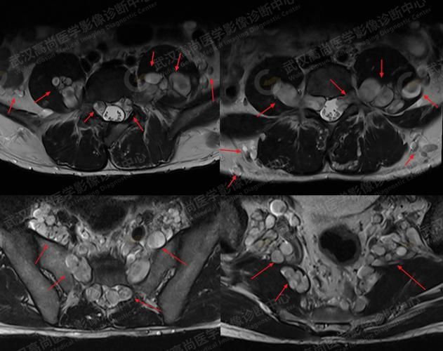 能否給出更多診斷案例,三甲醫院醫療診斷案例“1000字和配圖)能否給出更多診斷案例 龍魚百科 第3張 能否給出更多診斷案例,三甲醫院醫療診斷案例“1000字和配圖)能否給出更多診斷案例 能否給出更多診斷案例,三甲醫院醫療診斷案例“1000字和配圖)能否給出更多診斷案例 龍魚百科 第3張