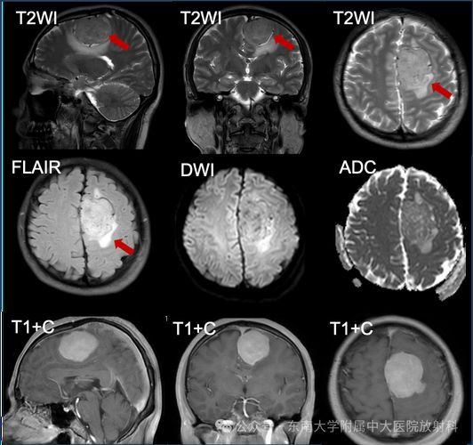 能否給出更多診斷案例，三甲醫(yī)院醫(yī)療診斷案例“1000字和配圖）能否給出更多診斷案例